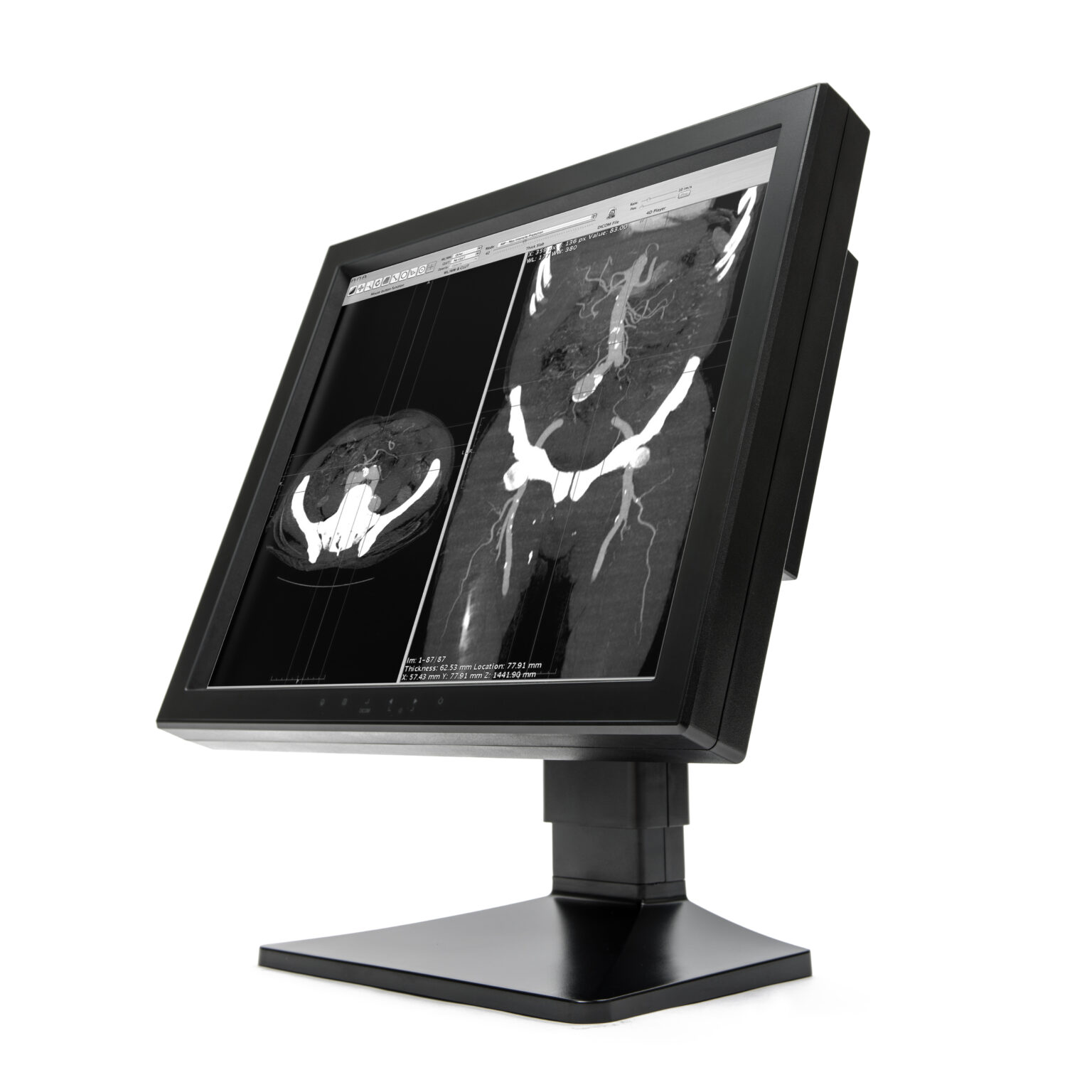 WIDE 19" 1mp Modality Mono Display (MX10P) Buy WIDEUSA Medical